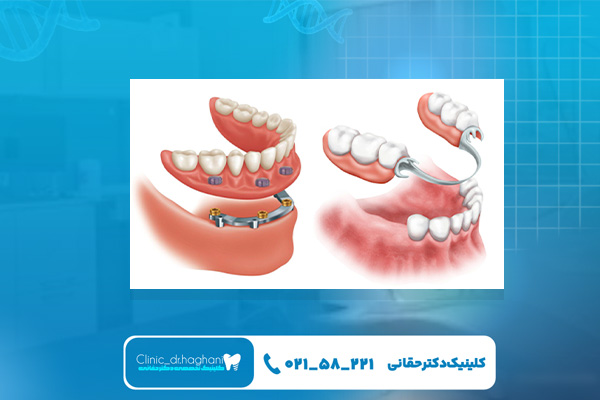 بهترین دندانپزشک پروتز دندان