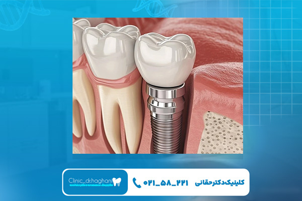 بهترین کلینیک دندانپزشکی حقانی در شمال شهر تهران