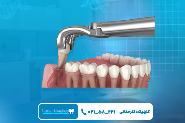 دندانپزشکی تهران