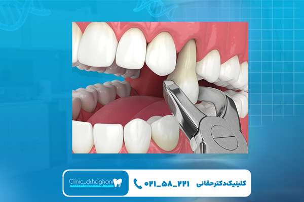 دندانپزشکی تهران