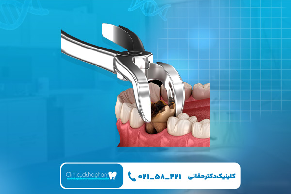 کلینیک دندانپزشکی تخصصی تهران کلینیک دندانپزشکی تخصصی تهران