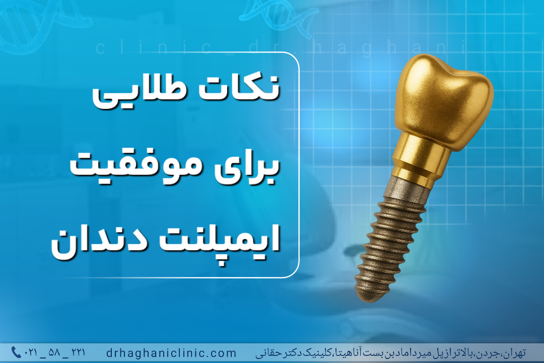 نکات طلایی برای موفقیت ایمپلنت دندان