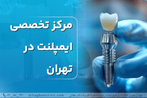 مرکز تخصصی ایمپلنت در تهران