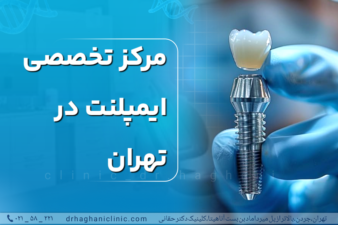 مرکز تخصصی ایمپلنت در تهران