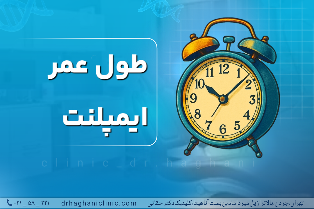 طول عمر ایمپلنت