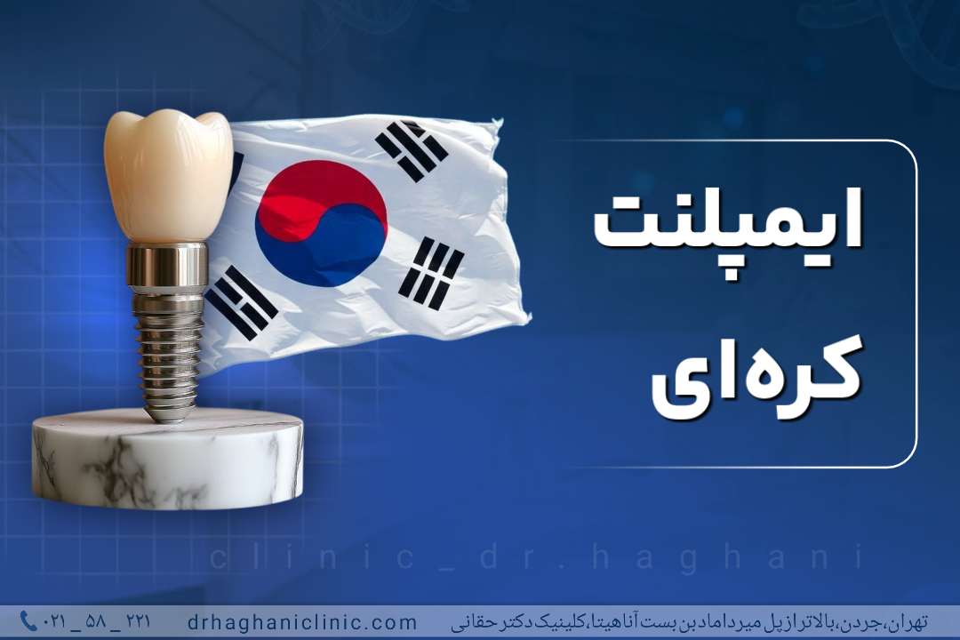 ایمپلنت کرهای