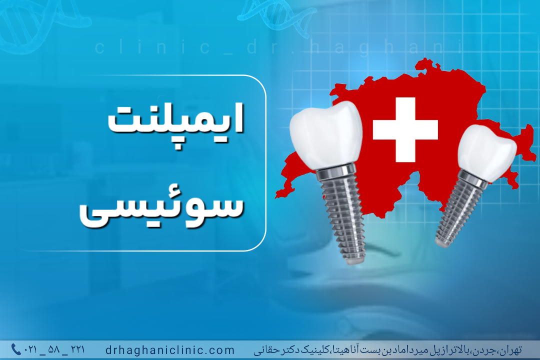ایمپلنت سوئیسی