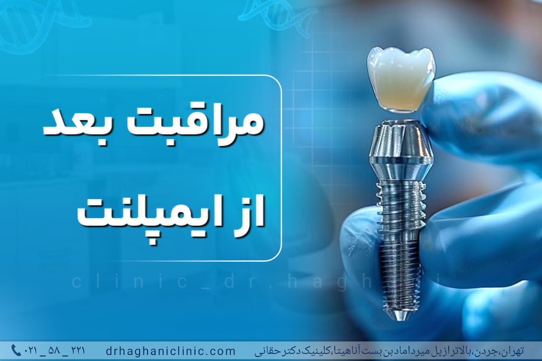 مراقبت بعد از ایمپلنت
