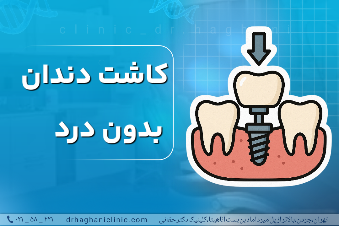 کاشت دندان بدون درد