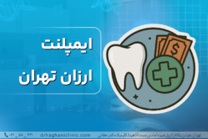 ایمپلنت ارزان تهران