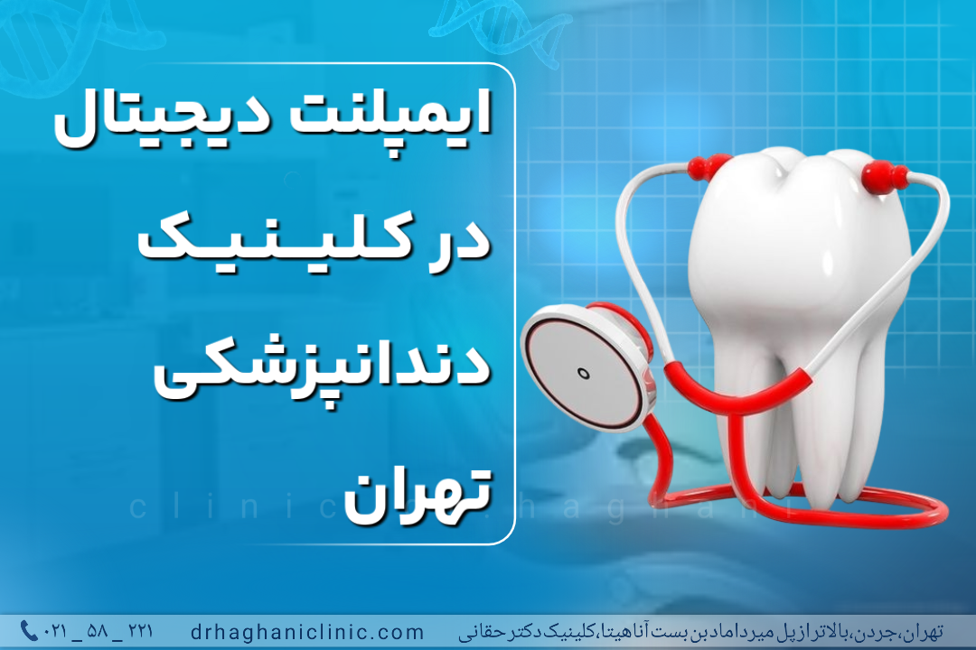 ایمپلنت دیجیتال در کلینیک دندانپزشکی تهران