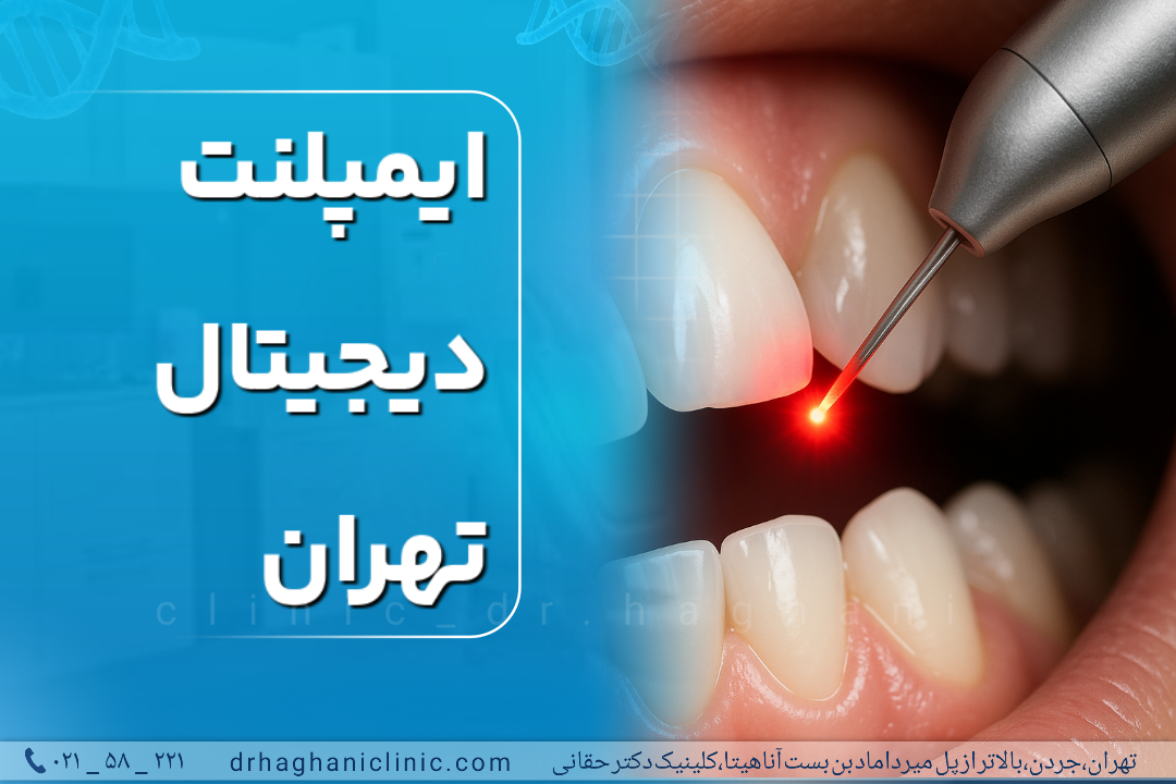 ایمپلنت دیجیتال تهران