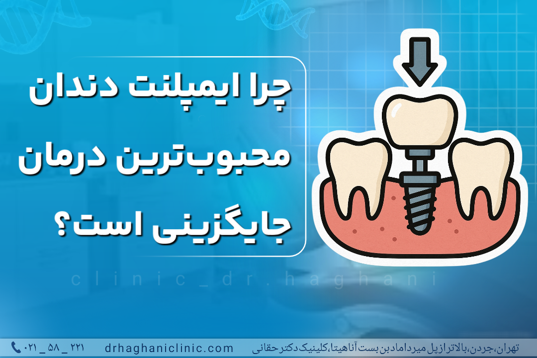 چرا ایمپلنت دندان محبوب ترین درمان جایگزین است؟