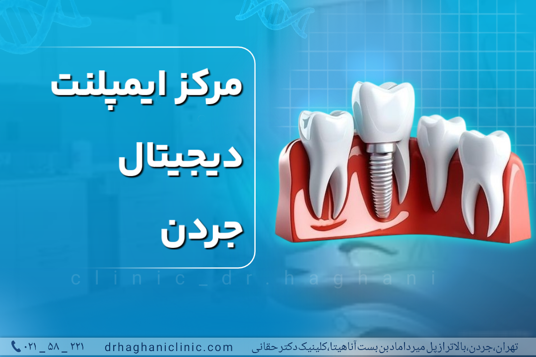 مرکز ایمپلنت دیجیتال جردن