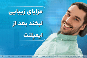 مزایای زیبایی لبخند بعد از ایمپلنت