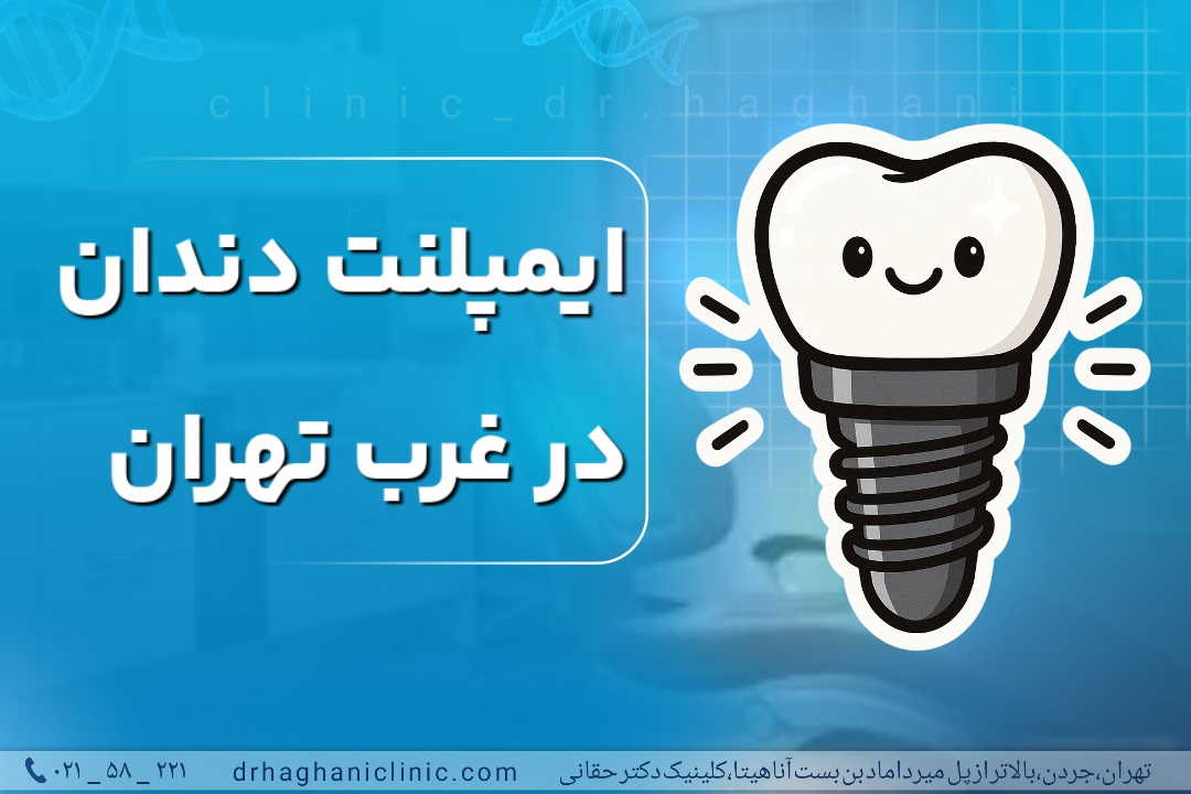 ایمپلنت دندان در غرب تهران