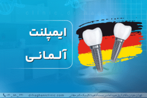 ایمپلنت آلمانی