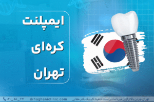 ایمپلنت کره‌ای تهران