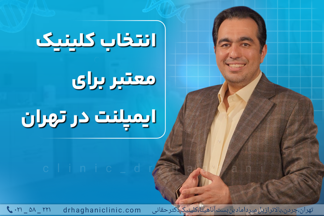 انتخاب کلینیک معتبر برای ایمپلنت در تهران
