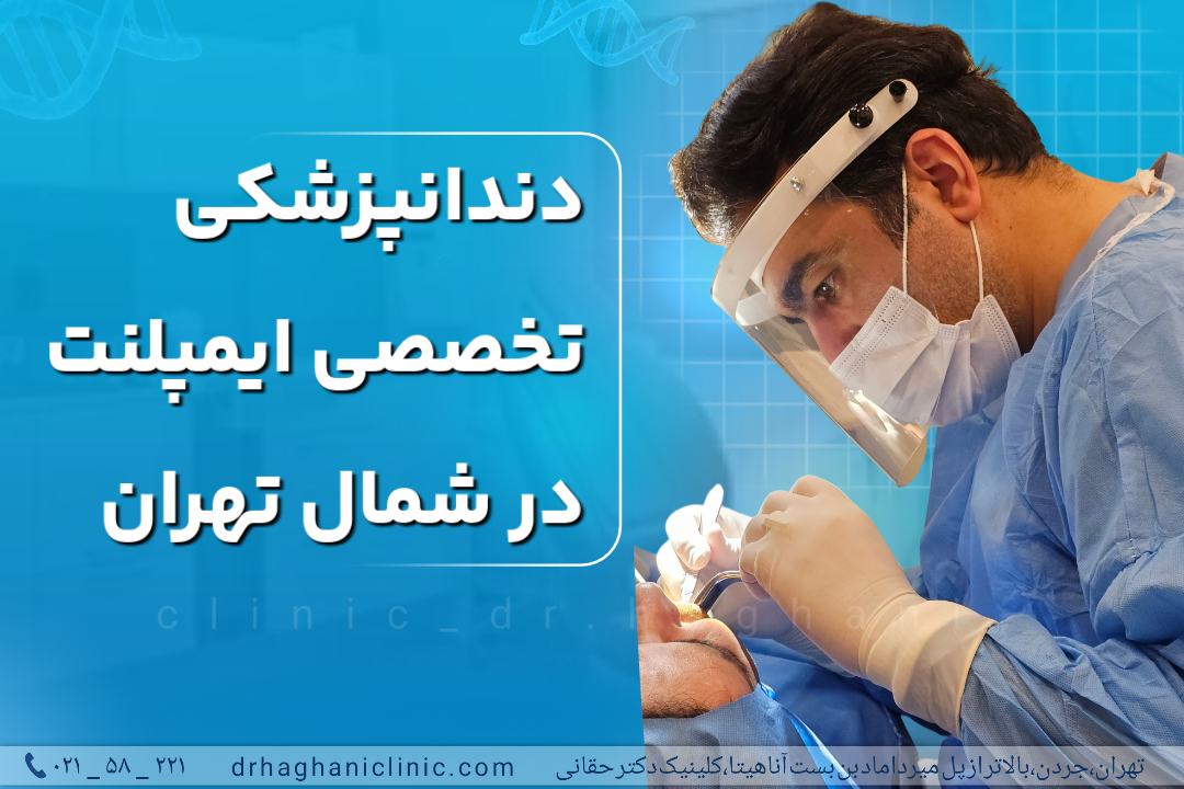 دندانپزشکی تخصصی ایمپلنت در شمال تهران