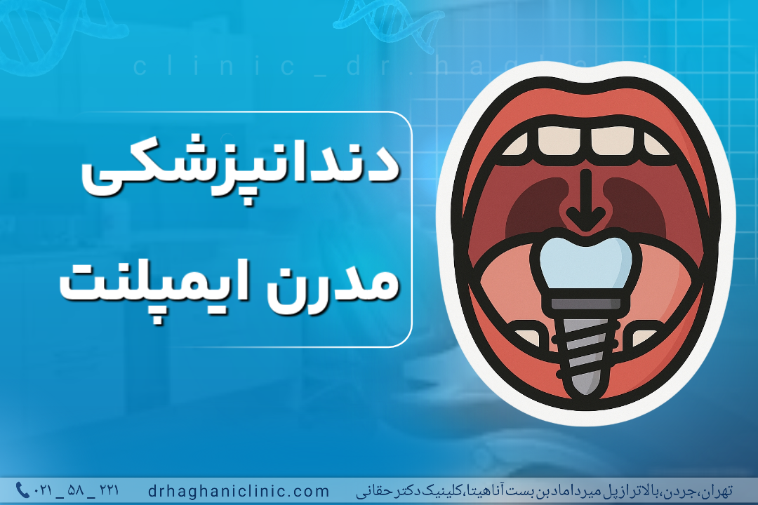دندانپزشکی مدرن ایمپلنت