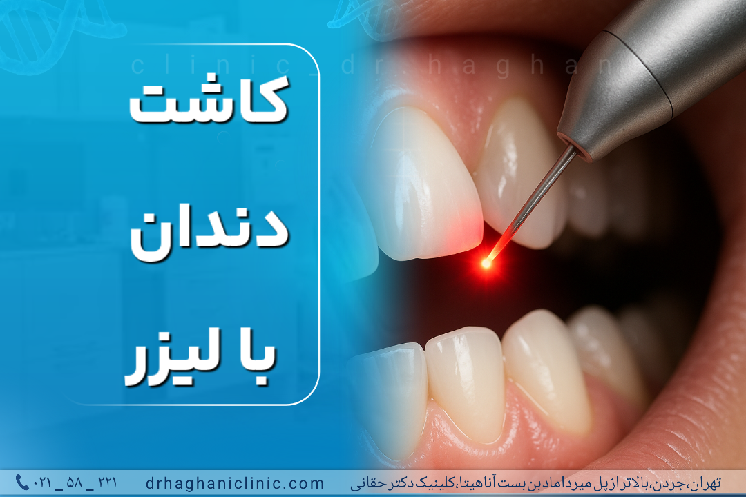 کاشت دندان با لیزر