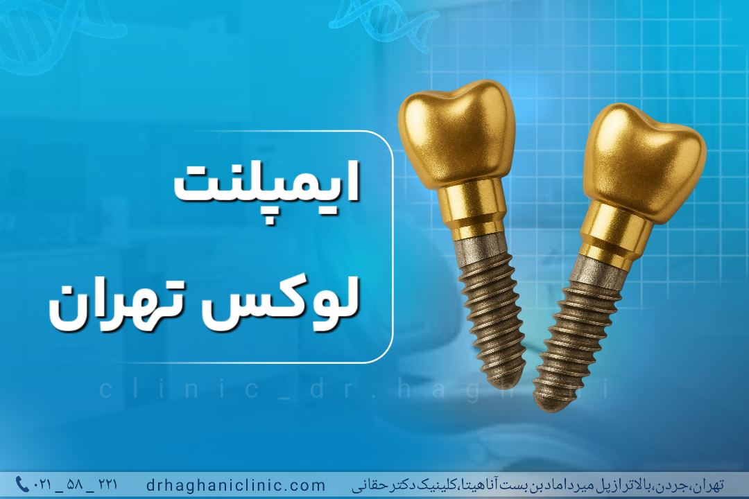 ایمپلنت لوکس تهران