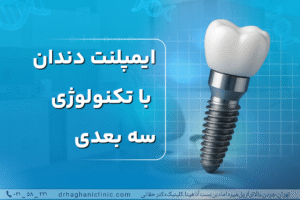 ایمپلنت دندان با تکنولوژی سه بعدی