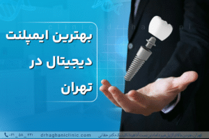 بهترین ایمپلنت دیجیتال در تهران