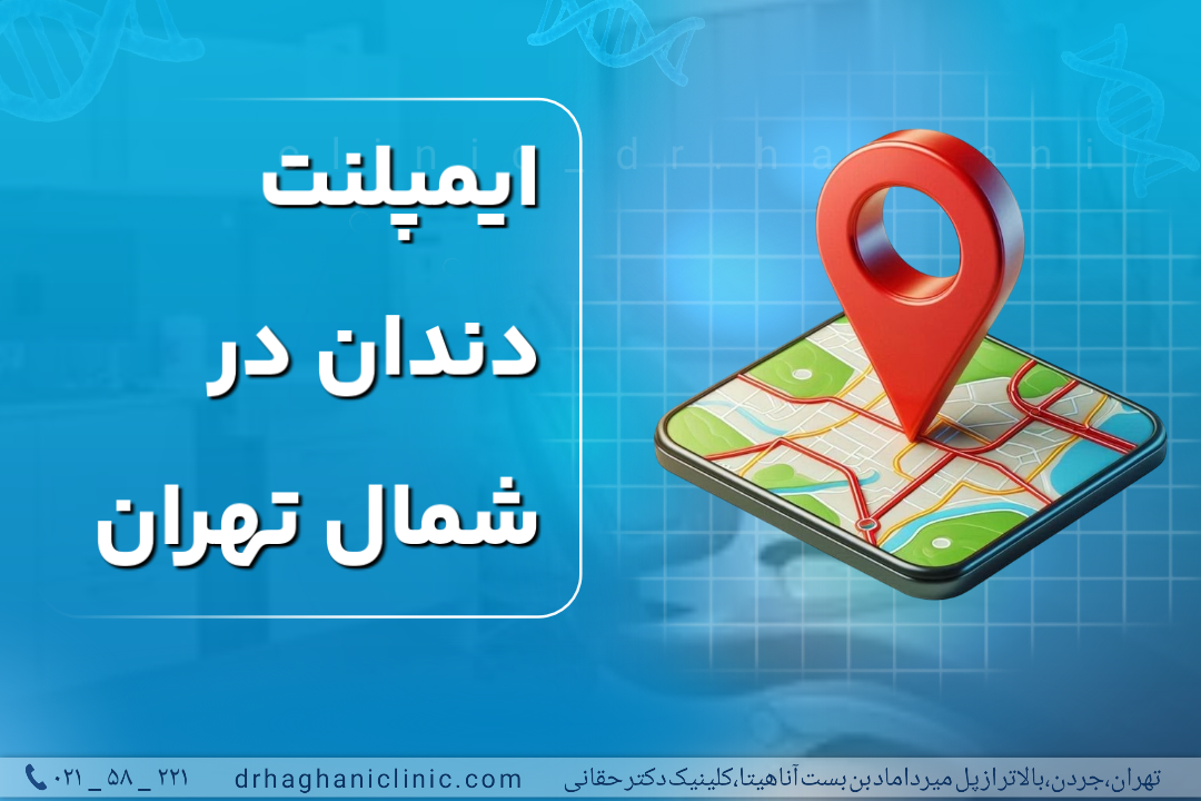 ایمپلنت دندان در شمال تهران