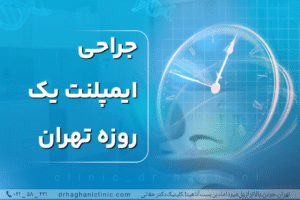 جراحی ایمپلنت یک روزه تهران