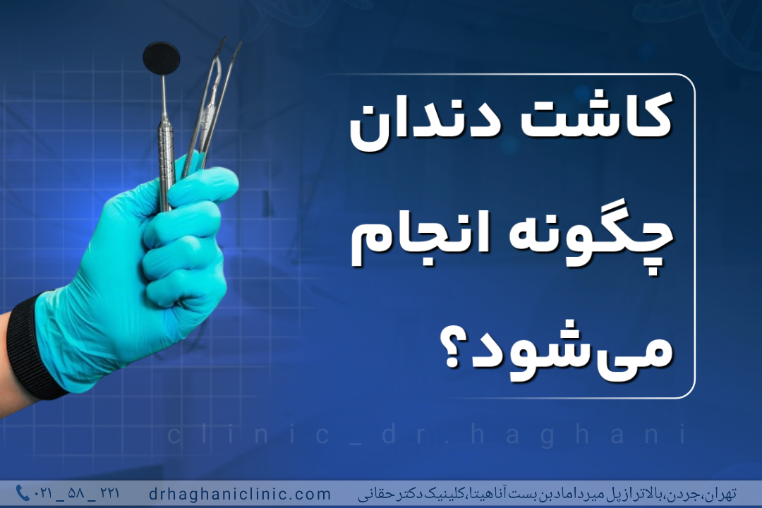 مراحل انجام ایمپلنت دندان