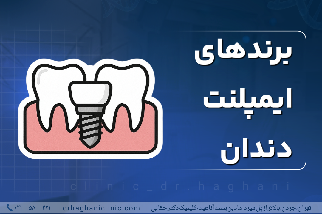 برند های ایمپلنت دندان