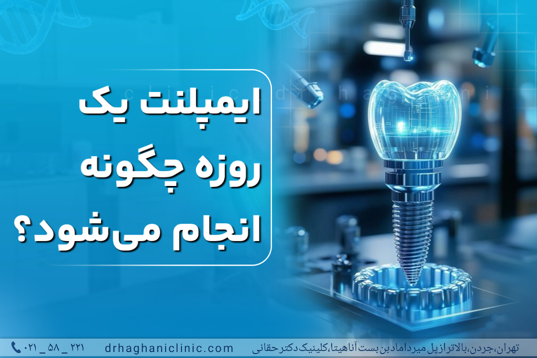 ایمپلنت دندان یک روزه چگونه انجام می شود؟