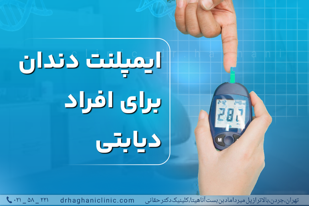 ایمپلنت دندان برای افراد دیابتی