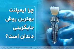 چرا ایمپلنت بهترین روش جایگزینی دندان است؟