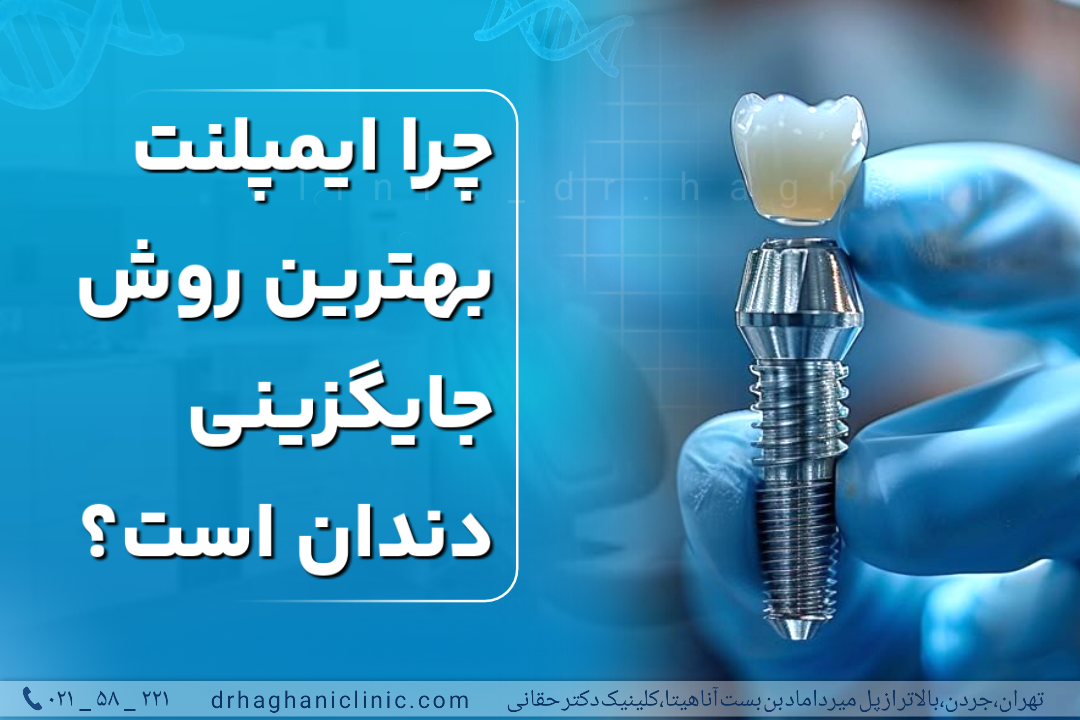 چرا ایمپلنت بهترین روش جایگزینی دندان است؟