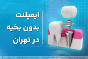 ایمپلنت بدون بخیه در تهران