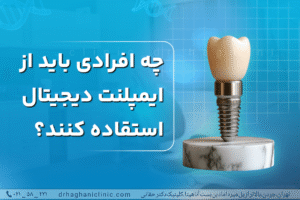 چه افرادی باید از ایمپلنت دیجیتال استفاده کنند؟