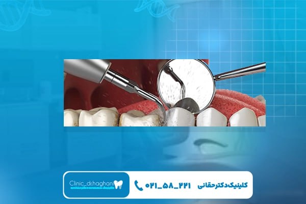 خدمات دندانپزشکی عمومی در کلینیک دکتر حقانی