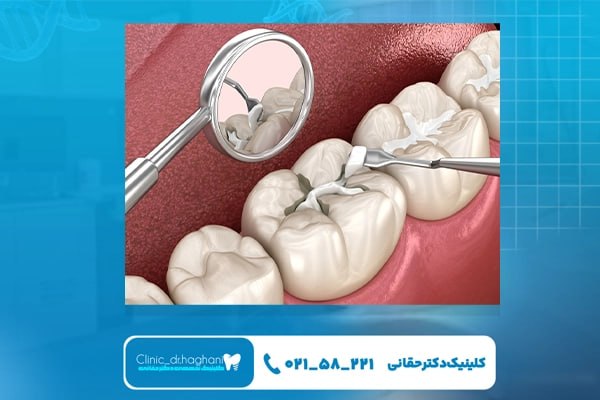 دندانپزشکی عمومی تهران