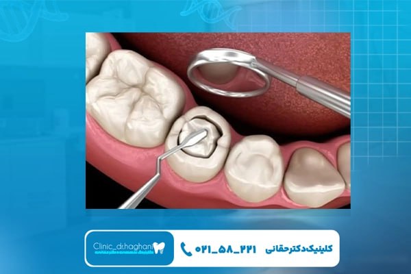 پیشگیری از بیماری دهان در دندانپزشکی عمومی تهران