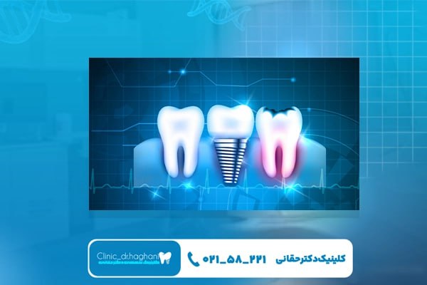 دندانپزشکی دیجیتال چیست؟