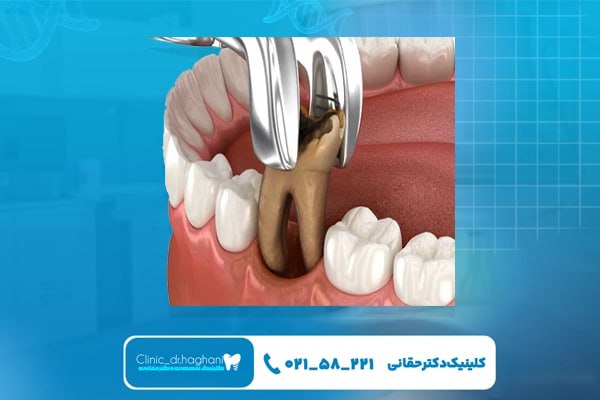 زیبایی دندان در مرکز دندانپزشکی زیبایی دندان در مرکز دندانپزشکی