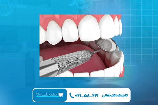 خدمات ترمیمی تخصصی برای دندانهای آسیب دیده خدمات ترمیمی تخصصی برای دندانهای آسیب دیده