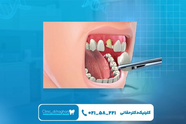 خدمات زیبایی دندان در مرکز دندانپزشکی نلسون ماندلا خدمات زیبایی دندان در مرکز دندانپزشکی نلسون ماندلا