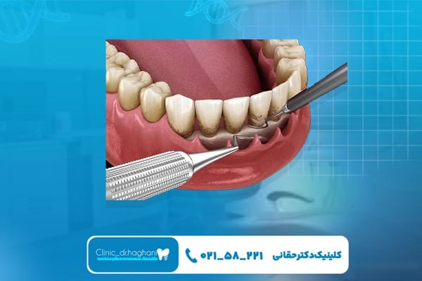 کلینیک دندانپزشکی شمال تهران