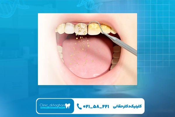 کلینیک دندانپزشکی شمال تهران