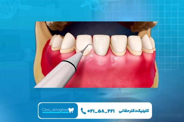 کلینیک دندانپزشکی شمال تهران