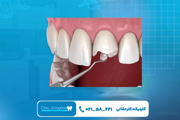 کلینیک دندانپزشکی تهران